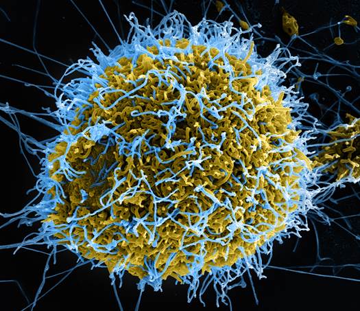 Why Testicles Are The Perfect Hiding Spot For Ebola
