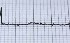 Heart attacks seem more common after extreme temperature changes